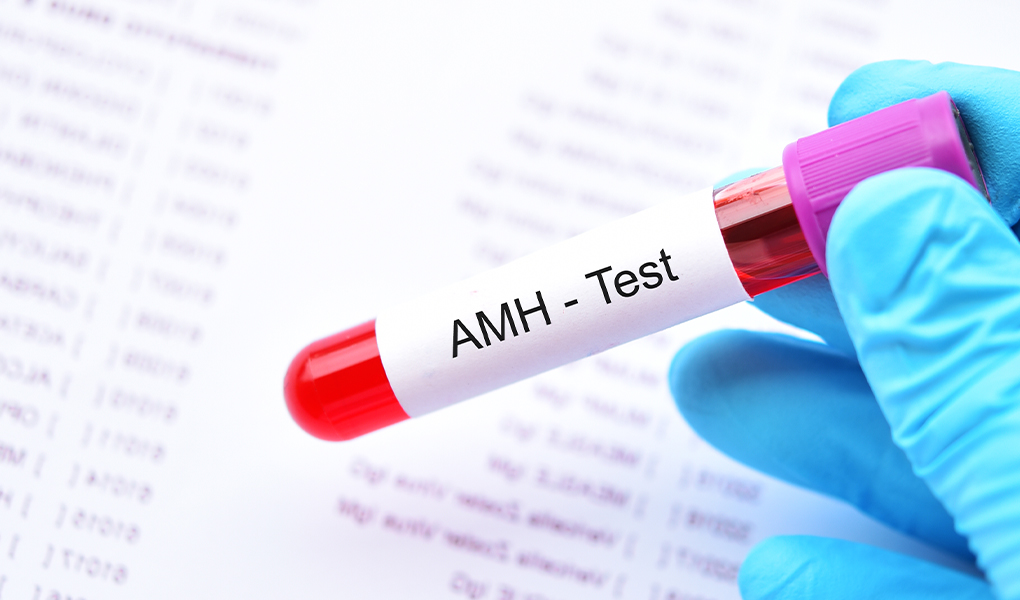 AMH blood test